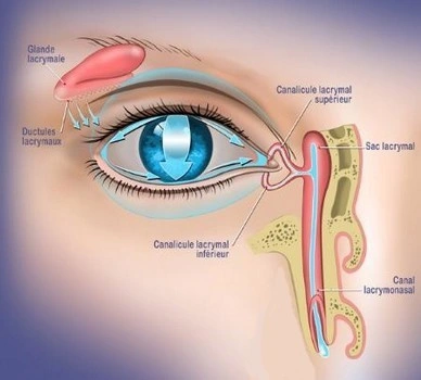 Traitement du larmoiement Chirurgie des voies lacrymales Dr Hervé Chenal IEVR Traitement du larmoiement Chirurgie des voies lacrymales Dr Hervé Chenal IEVR